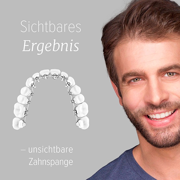 unsichtbare-zahnspange-erwachsene